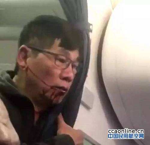 被美聯航強行拉下飛機的旅客的問題